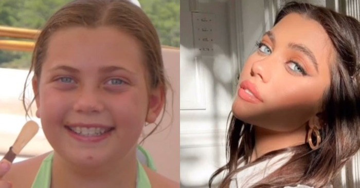  Here are the transformations: teenagers who have matured and began to look much better
