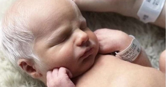  „Einzigartiges Kind Jahre später“: So sieht das mit weißen Haaren geborene Baby 9 Jahre später aus